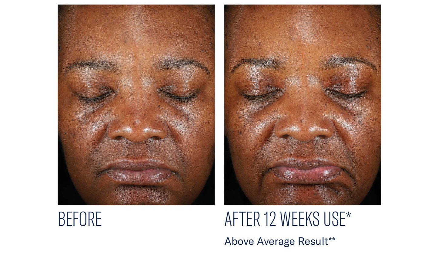 Even Intensive Skin Tone Correcting Serum 50 ml