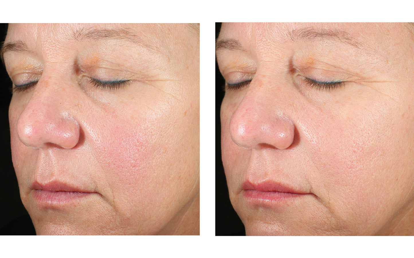 Alto Advanced Defense and Repair Serum 50 ml