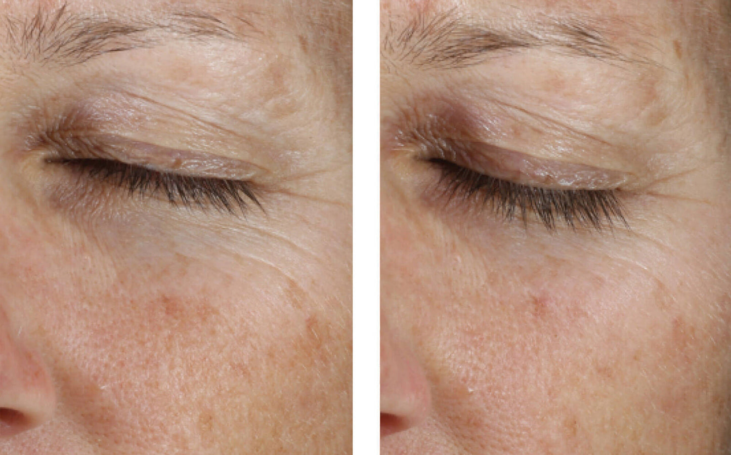 Instant Effect Gel EYE 15 ml