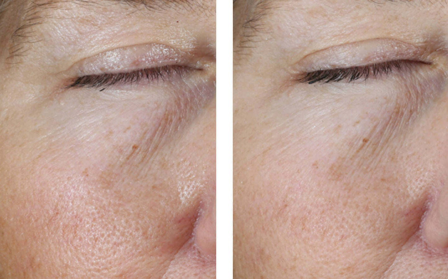 Instant Effect Gel EYE 15 ml