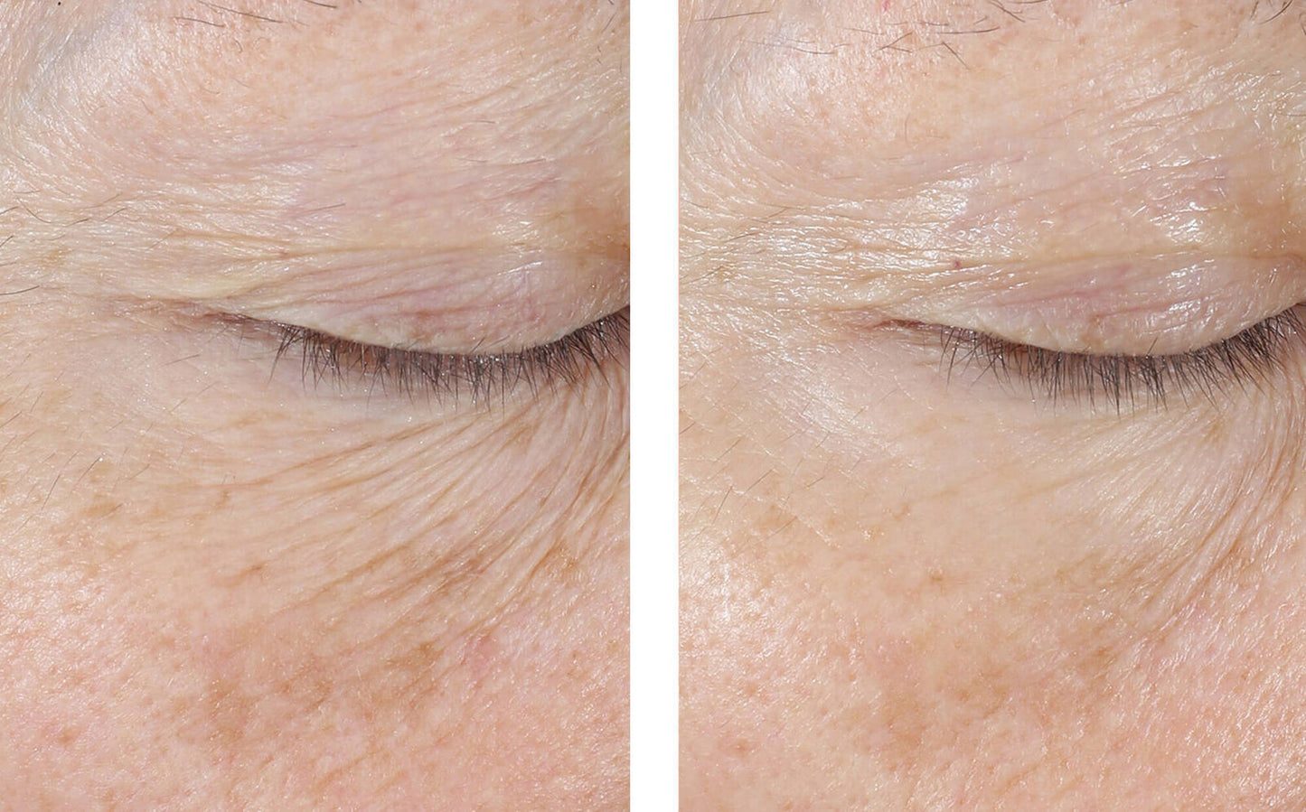 InterFuse Treatment Cream EYE 15 ml