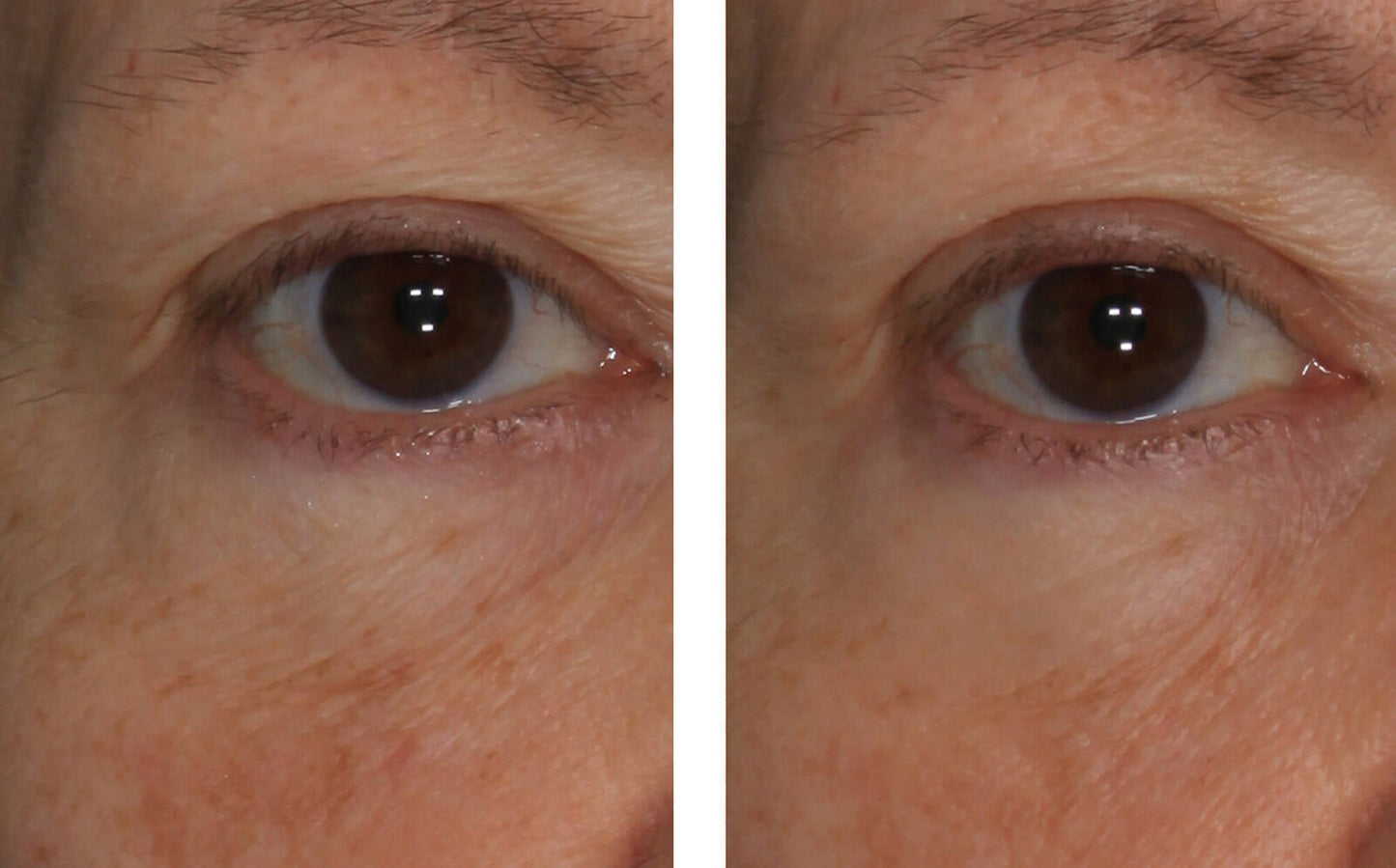 InterFuse Treatment Cream EYE 15 ml