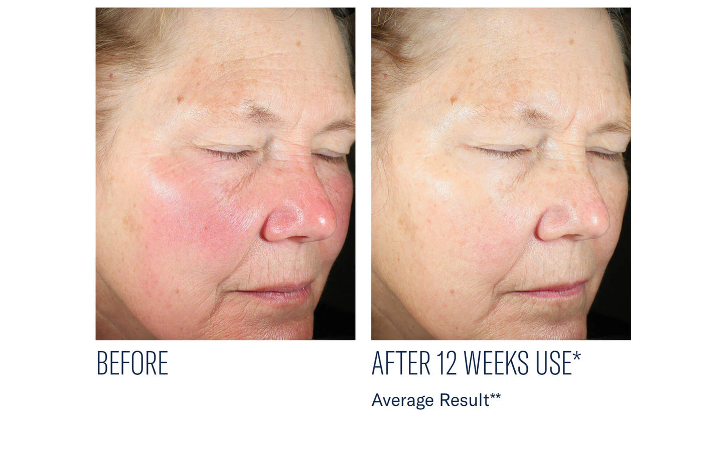 Even Intensive Skin Tone Correcting Serum 50 ml